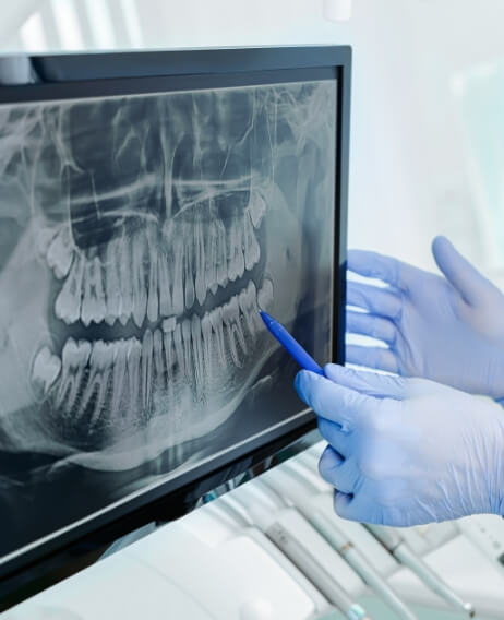 Dentist gesturing to computer screen showing digital x rays of teeth