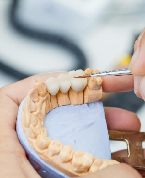 Ceramist creating a dental bridge