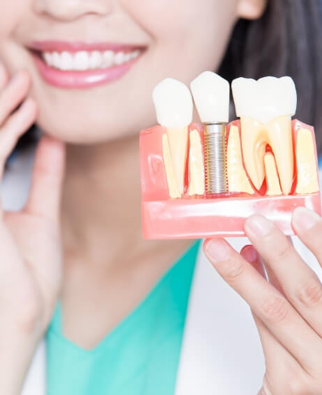 Smiling dentist holding a model of a dental implant