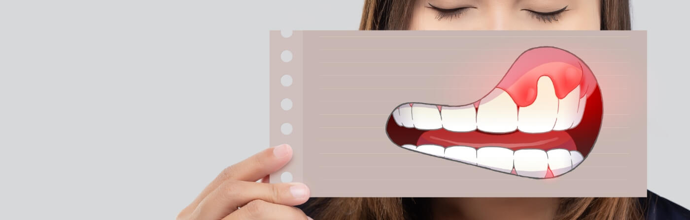 Person holding paper in front of their face with mouth with red gums