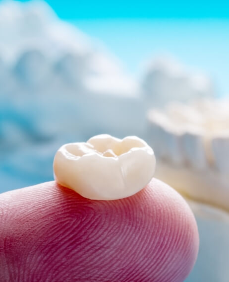 Close up of a dental crown resting on a finger