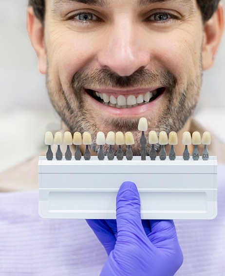 a smiling man with a shade chart in front of his teeth